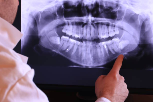 Best Walk-In Emergency Dentist in Lamar, TX