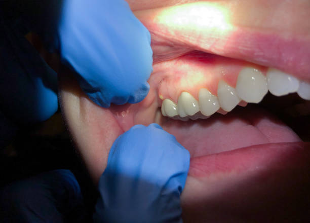 Best Emergency Treatment for Toothache in Lamar, TX